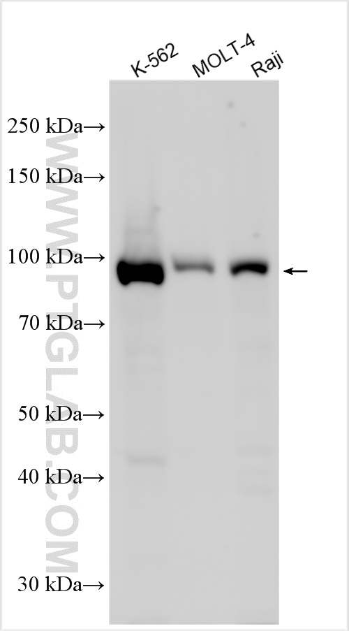 VPS35L