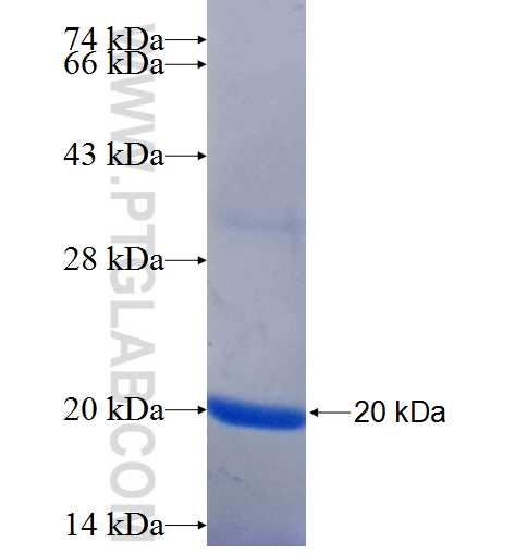 C16orf62 fusion protein Ag25633 SDS-PAGE