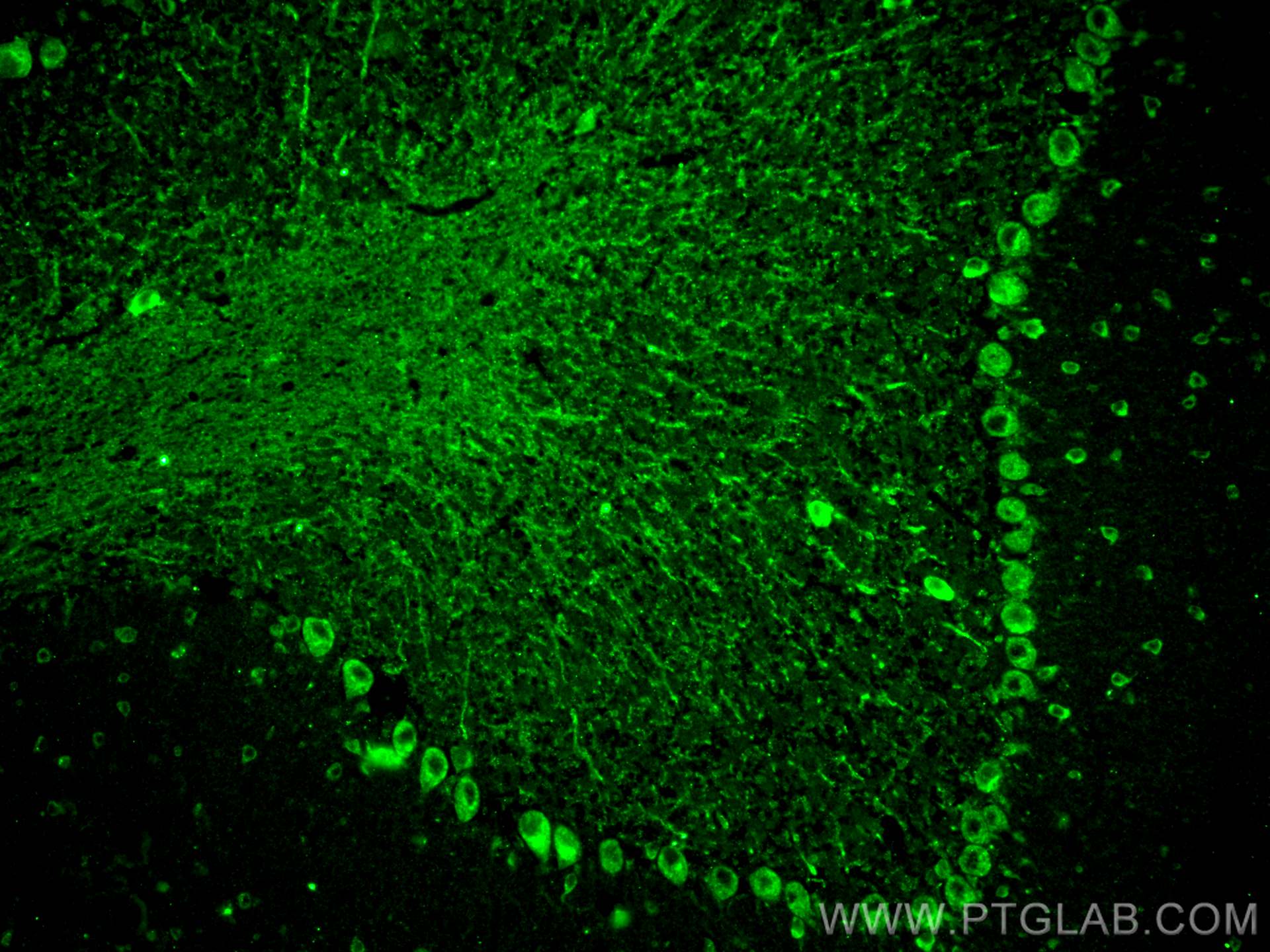 Immunofluorescence (IF) / fluorescent staining of mouse cerebellum tissue using C17orf57 Polyclonal antibody (27603-1-AP)