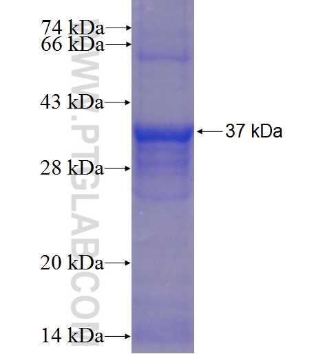 C17orf58 fusion protein Ag23344 SDS-PAGE