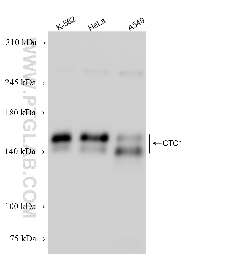 C17orf68