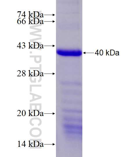 C17orf71 fusion protein Ag27835 SDS-PAGE