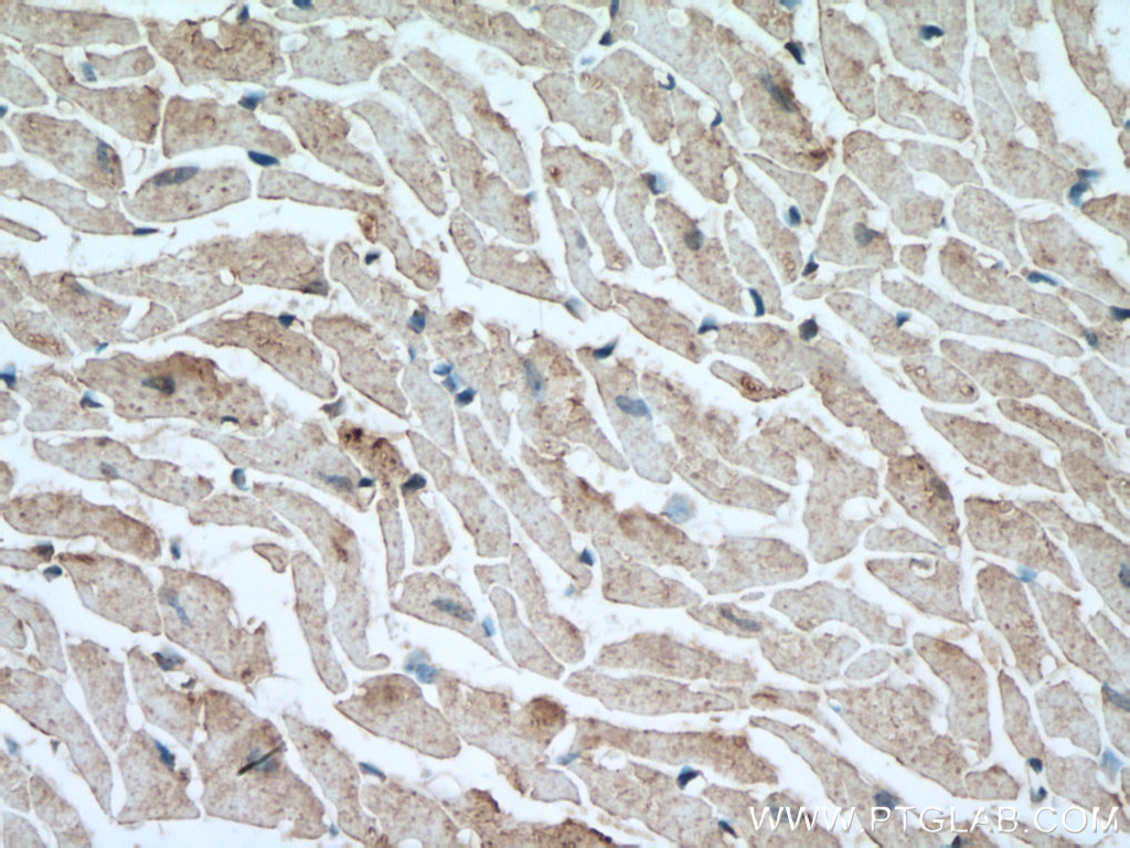 Immunohistochemistry (IHC) staining of mouse heart tissue using C17orf81 Polyclonal antibody (10162-1-AP)