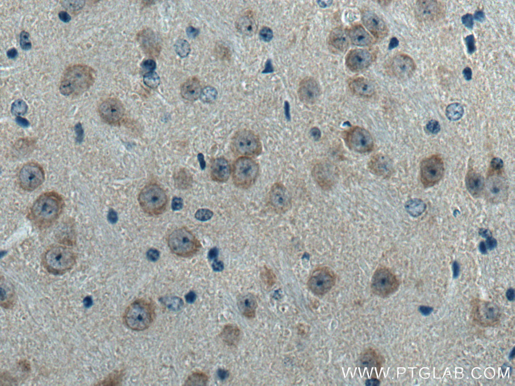 Immunohistochemistry (IHC) staining of mouse brain tissue using C17orf81 Polyclonal antibody (10162-1-AP)