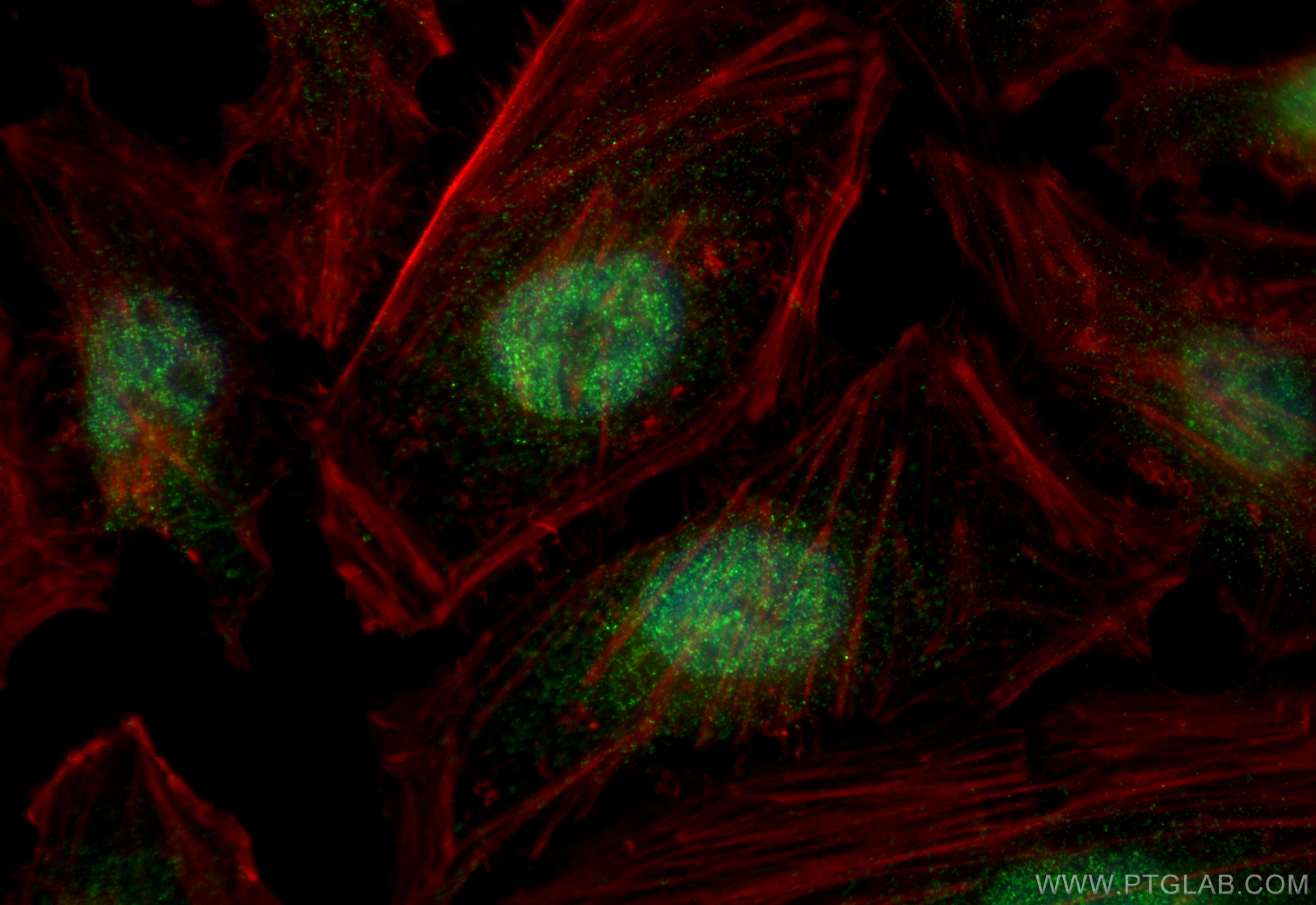 Immunofluorescence (IF) / fluorescent staining of HeLa cells using NCBP3 Polyclonal antibody (24384-1-AP)
