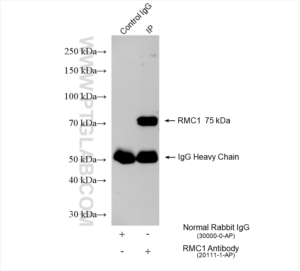 Immunoprecipitation (IP) experiment of MCF-7 cells using RMC1 Polyclonal antibody (20111-1-AP)