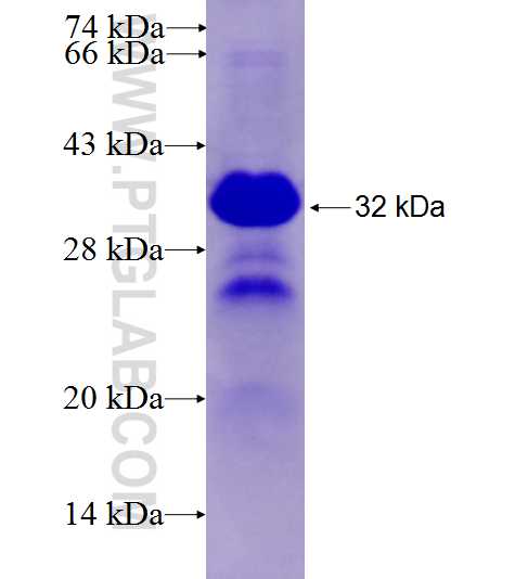 C19orf26 fusion protein Ag27781 SDS-PAGE