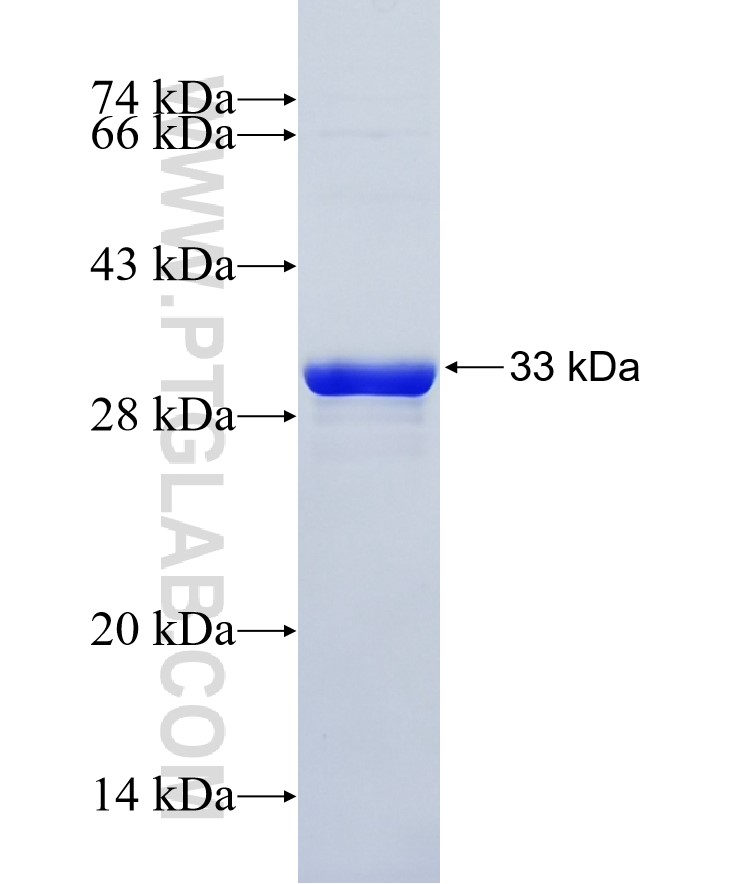 C19orf33 fusion protein Ag22218 SDS-PAGE