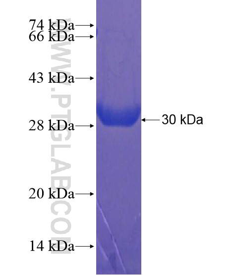 C19orf39 fusion protein Ag21678 SDS-PAGE