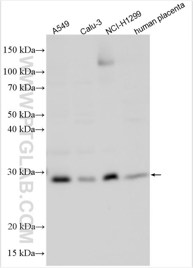 Western Blot (WB) analysis of various lysates using C19orf50 Polyclonal antibody (20492-1-AP)