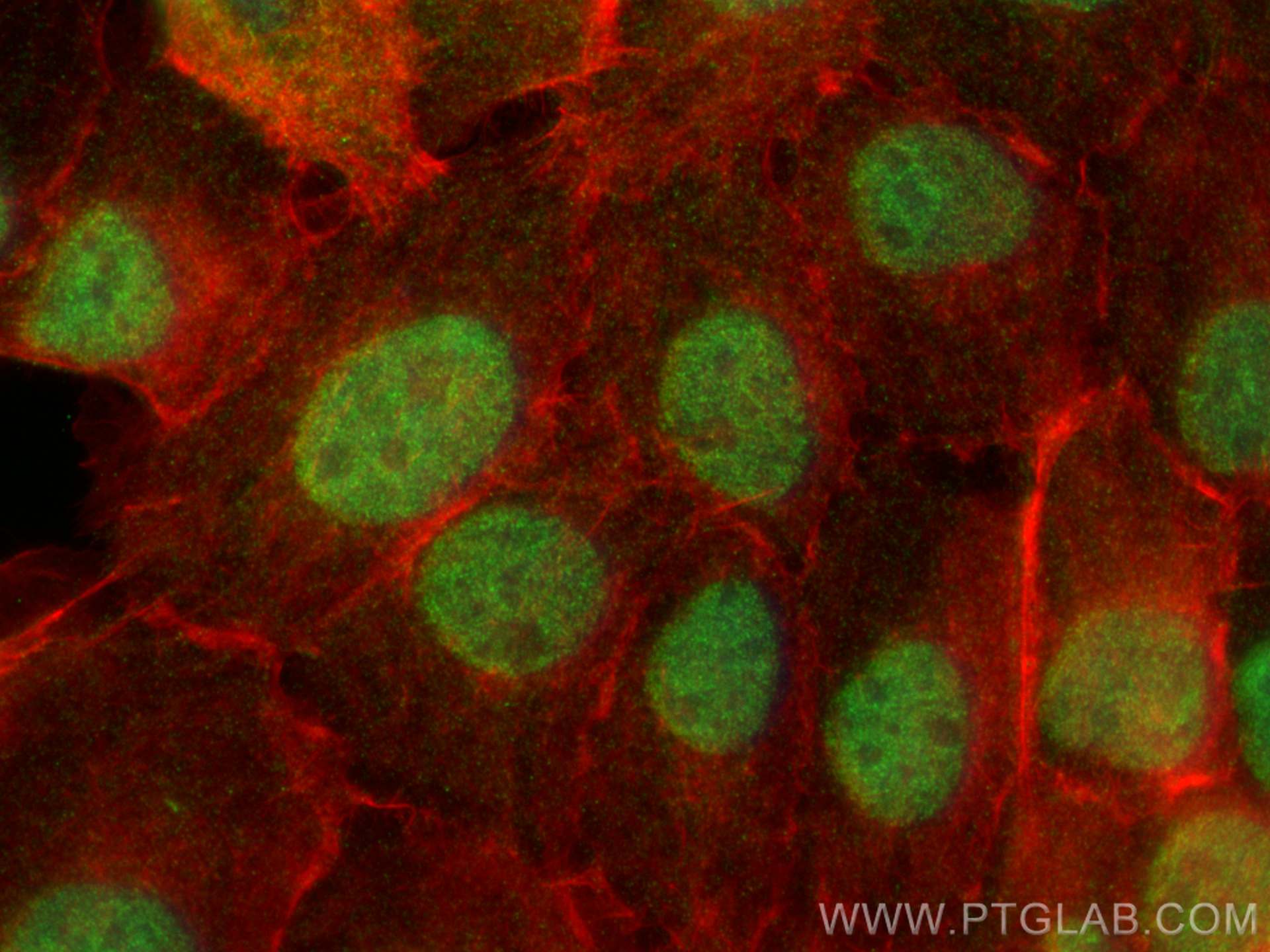 Immunofluorescence (IF) / fluorescent staining of A431 cells using C19orf57 Polyclonal antibody (25050-1-AP)