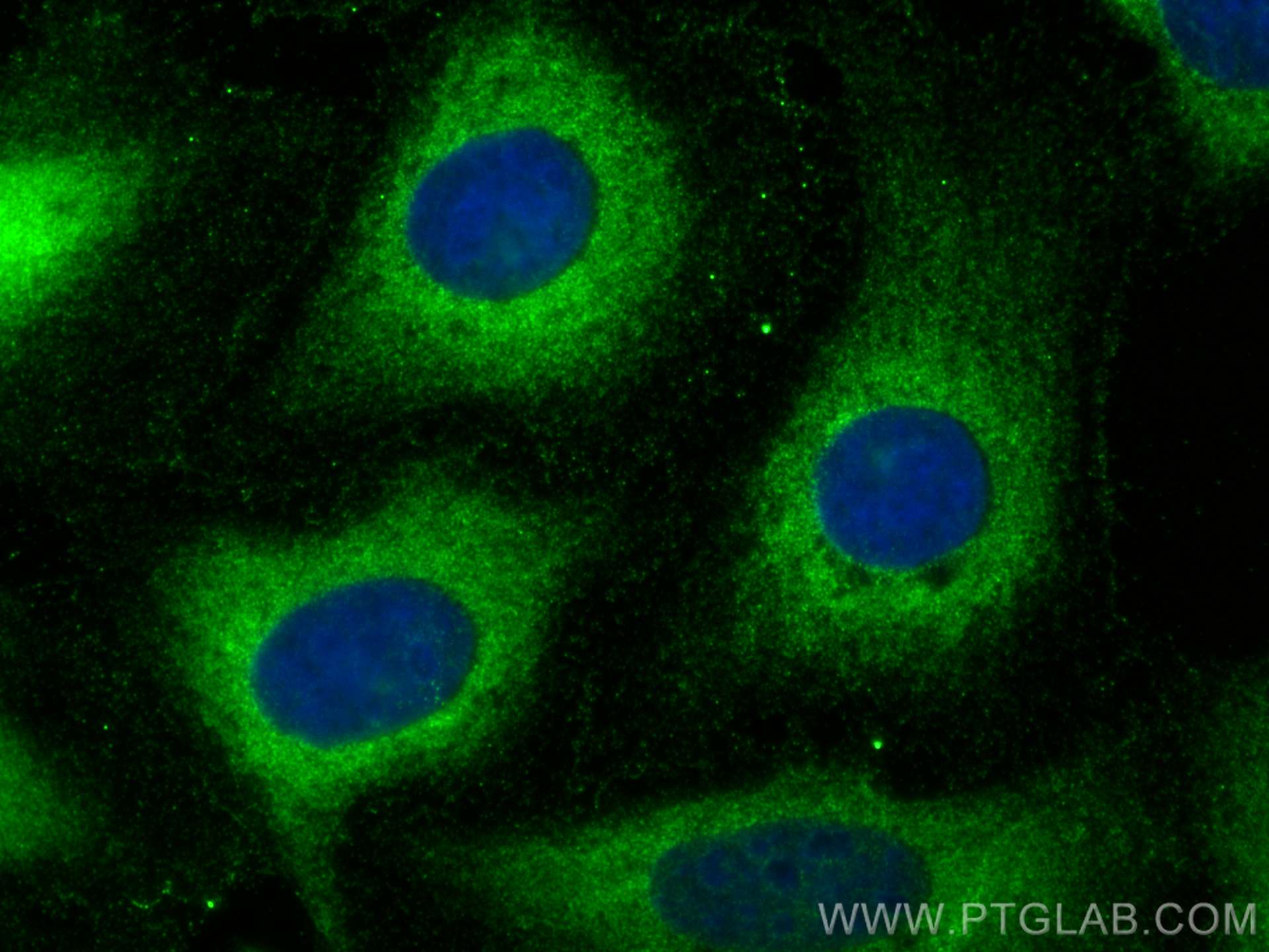 Immunofluorescence (IF) / fluorescent staining of U2OS cells using C19orf61 Polyclonal antibody (24797-1-AP)