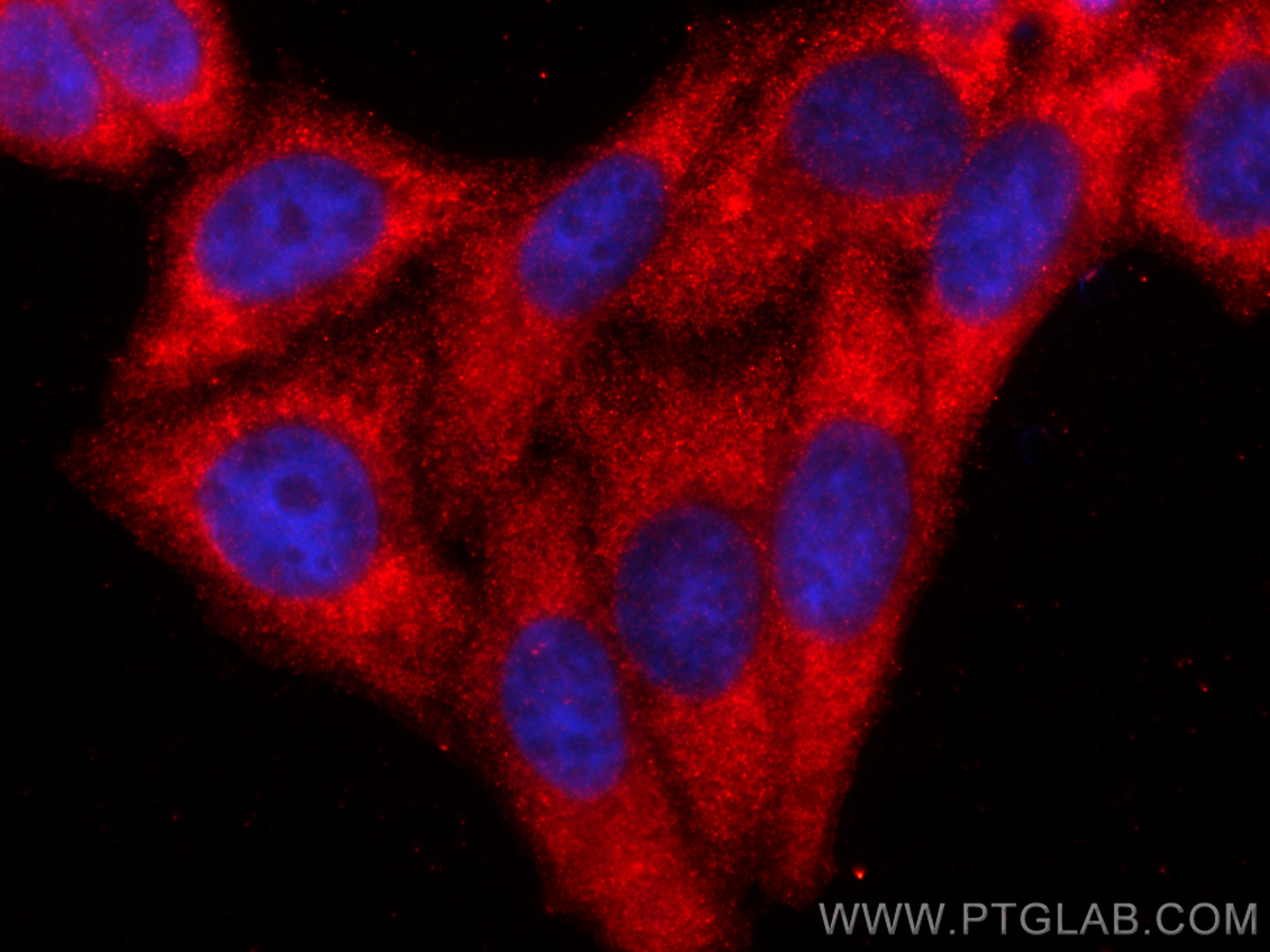 Immunofluorescence (IF) / fluorescent staining of HepG2 cells using C1QA Polyclonal antibody (11602-1-AP)