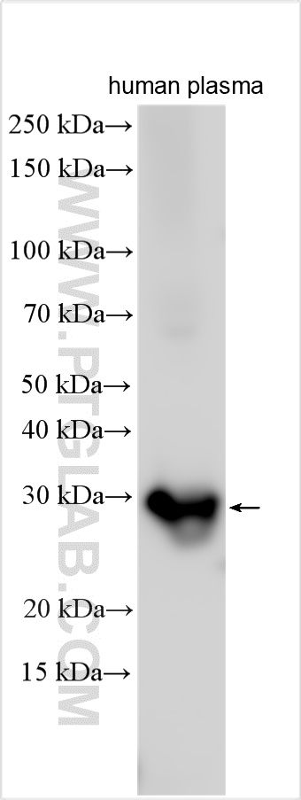 Western Blot (WB) analysis of various lysates using C1QA Polyclonal antibody (11602-1-AP)