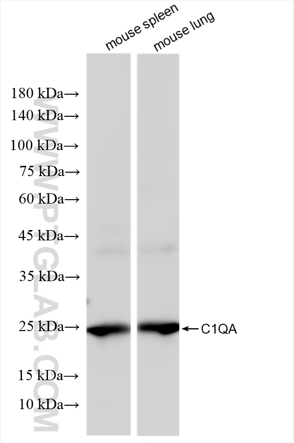 Western Blot (WB) analysis of various lysates using C1QA Recombinant antibody (85719-4-RR)