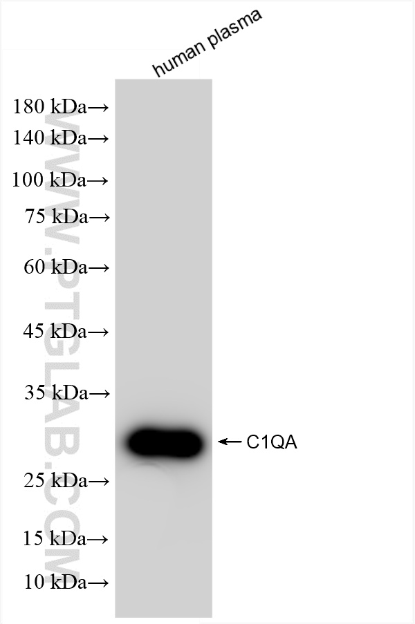 Western Blot (WB) analysis of various lysates using C1QA Recombinant antibody (85719-5-RR)