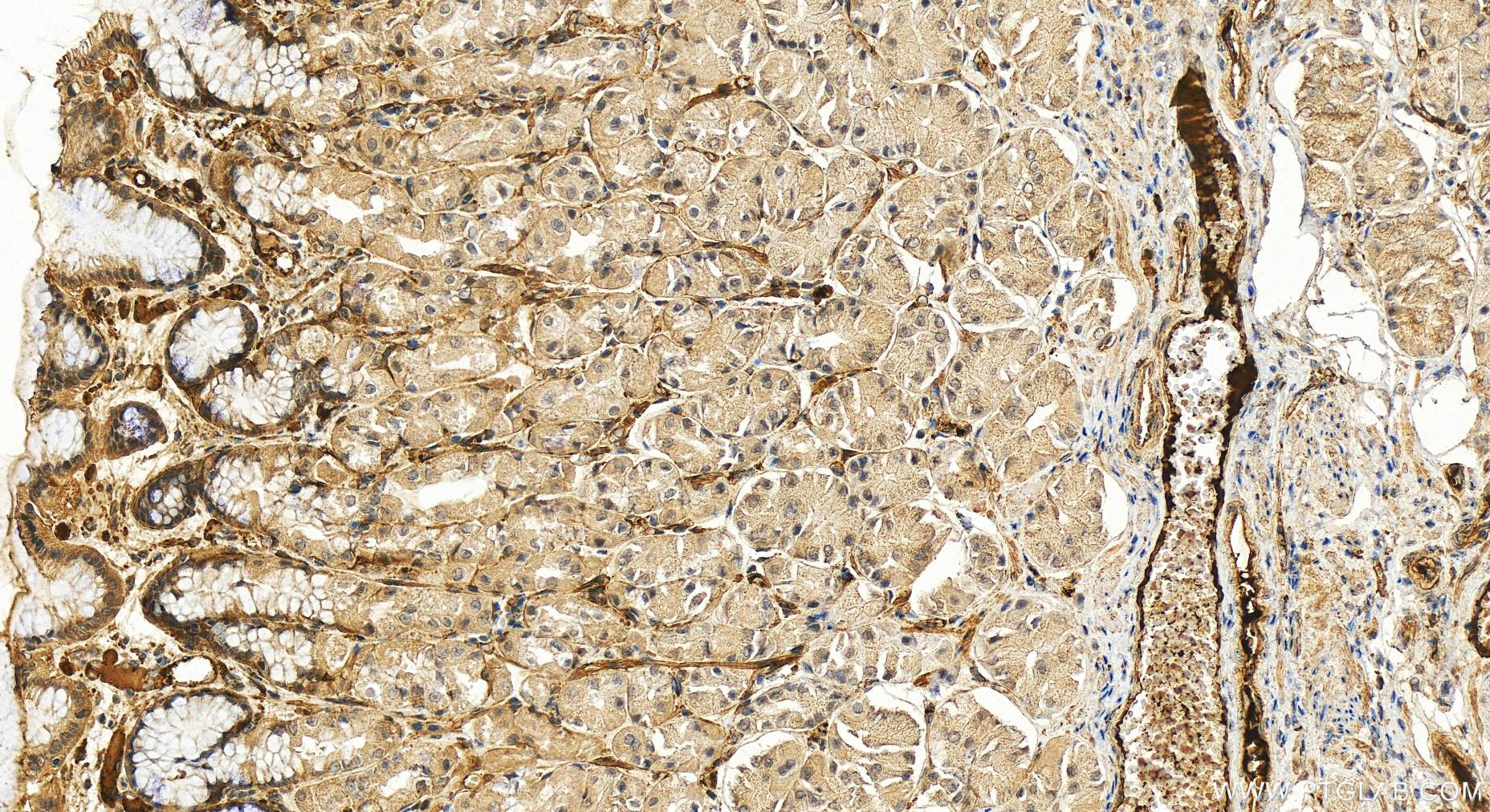 Immunohistochemistry (IHC) staining of human stomach tissue using C1qB Polyclonal antibody (16919-1-AP)