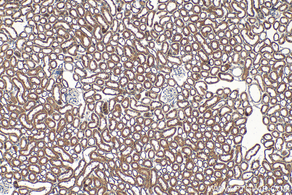 Immunohistochemistry (IHC) staining of mouse kidney tissue using C1QBP Polyclonal antibody (24474-1-AP)