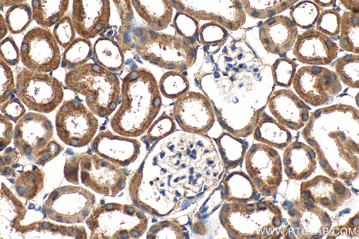 Immunohistochemistry (IHC) staining of mouse kidney tissue using C1QBP Polyclonal antibody (24474-1-AP)