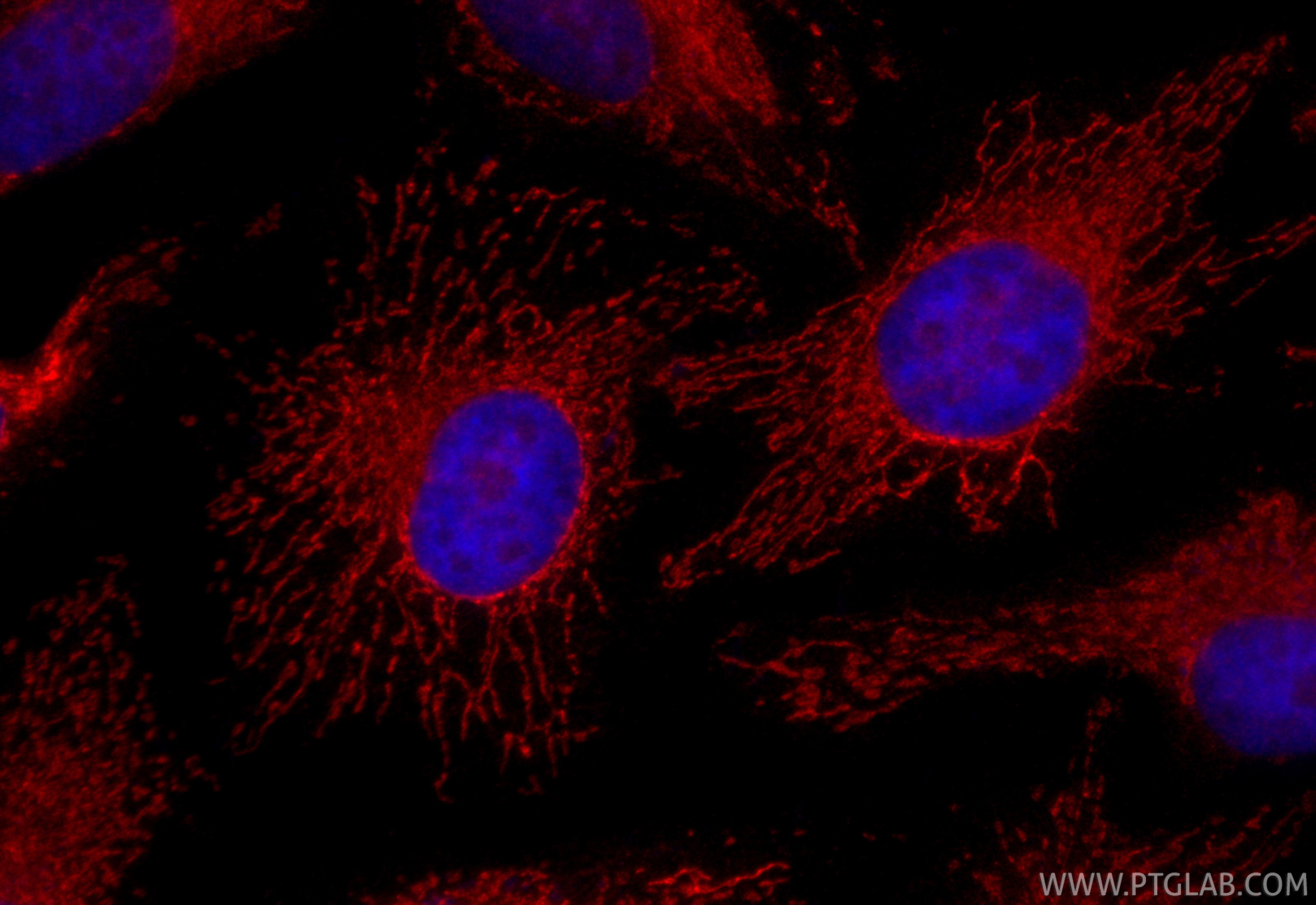 Immunofluorescence (IF) / fluorescent staining of HeLa cells using Cardinal Red™-conjugated C1QBP Polyclonal antibody (CR-24474)