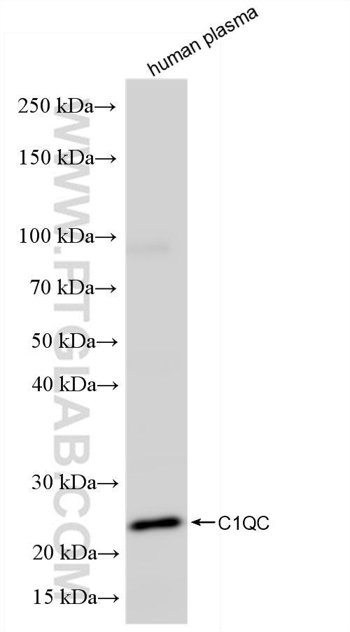 Western Blot (WB) analysis of human plasma using C1qC Recombinant antibody (85031-5-RR)
