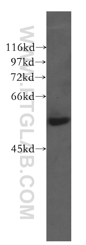 Western Blot (WB) analysis of HeLa cells using CTRP6 Polyclonal antibody (51030-1-AP)