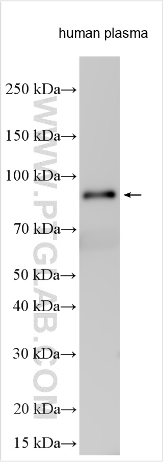 Western Blot (WB) analysis of various lysates using C1r Polyclonal antibody (17346-1-AP)