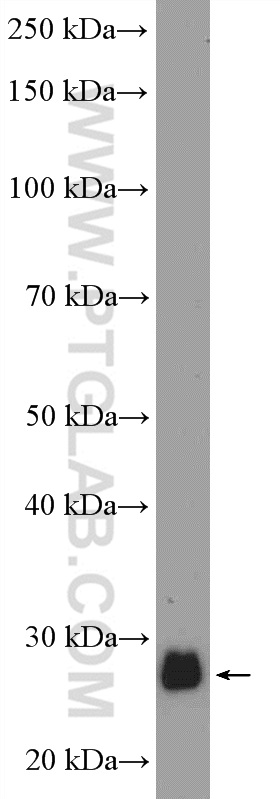 Western Blot (WB) analysis of mouse liver tissue using C1orf103 Polyclonal antibody (26115-1-AP)