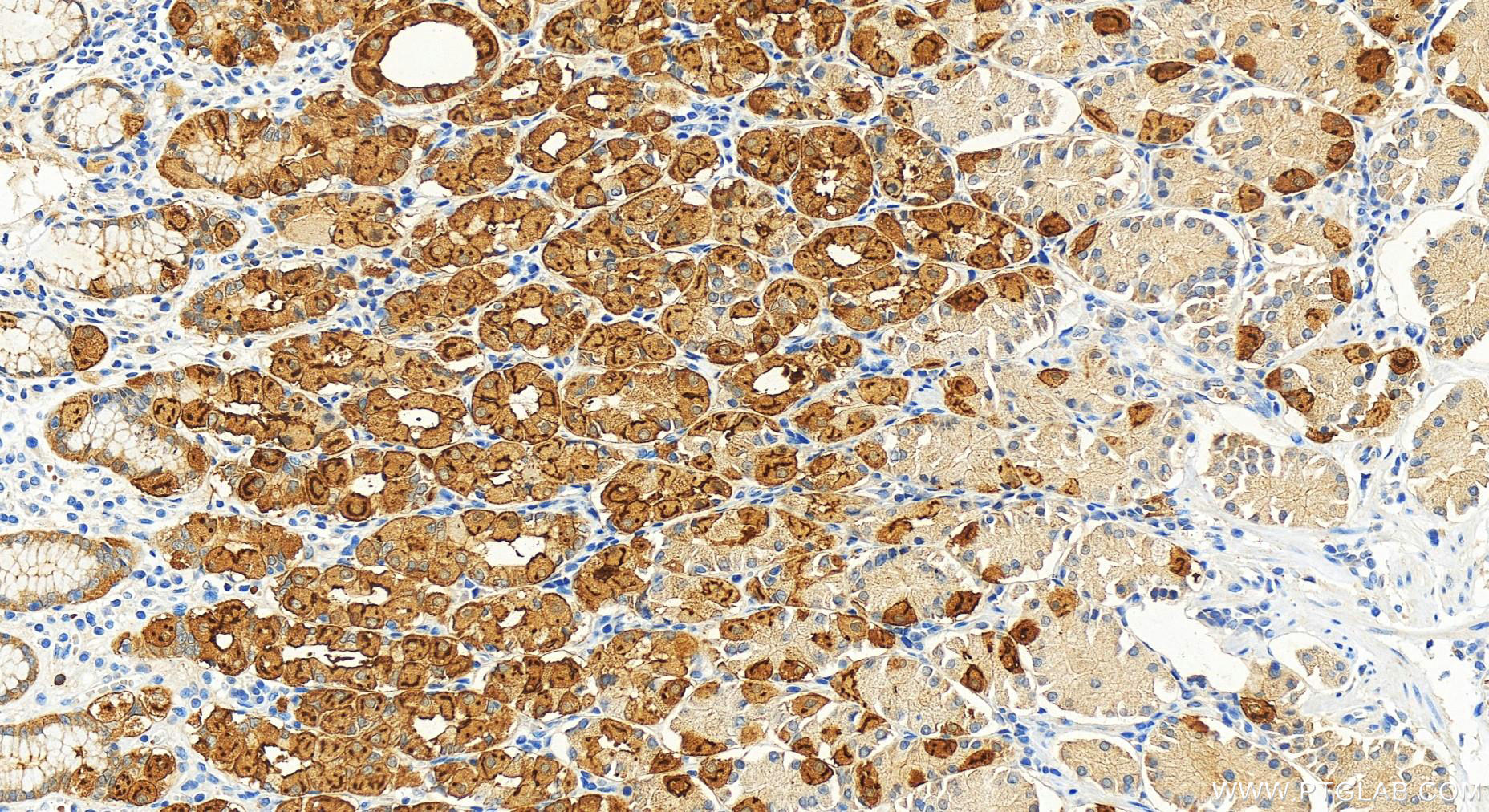 Immunohistochemistry (IHC) staining of human stomach tissue using C1orf116 Polyclonal antibody (14888-1-AP)