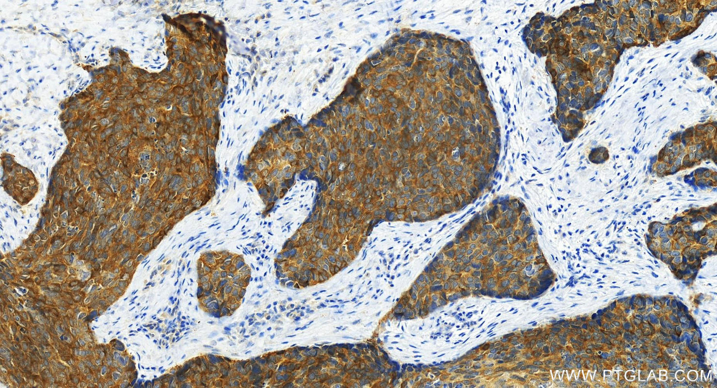 Immunohistochemistry (IHC) staining of human brown disease using C1orf116 Polyclonal antibody (14888-1-AP)