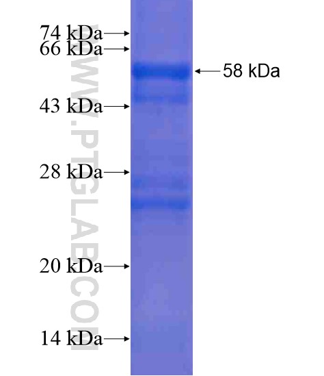 C1orf124 fusion protein Ag20586 SDS-PAGE