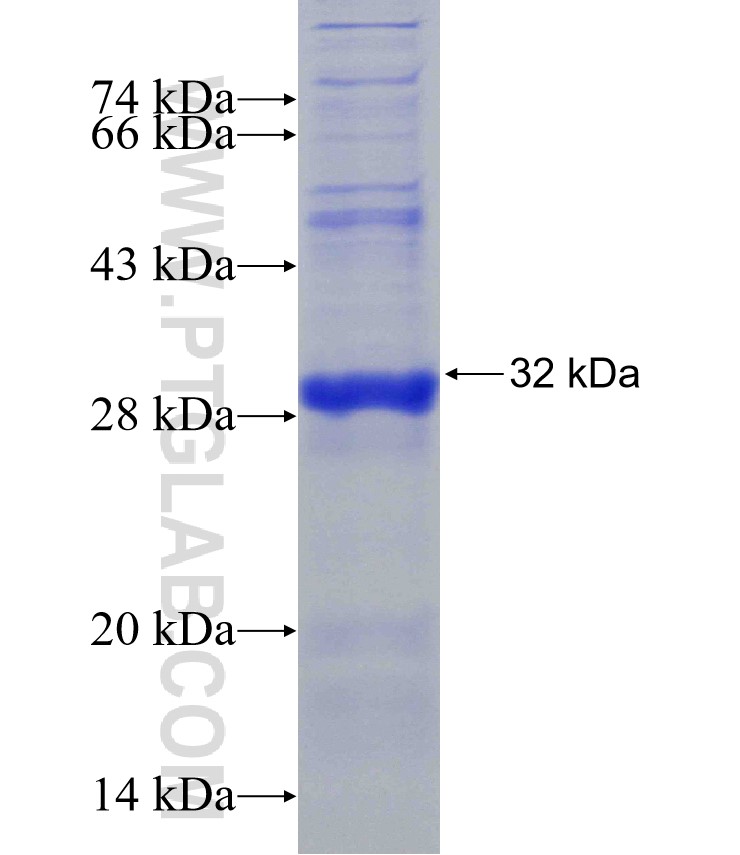 C1orf170 fusion protein Ag23833 SDS-PAGE