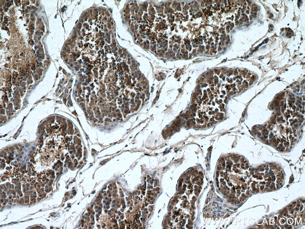 Immunohistochemistry (IHC) staining of human testis tissue using TEX38 Polyclonal antibody (24429-1-AP)