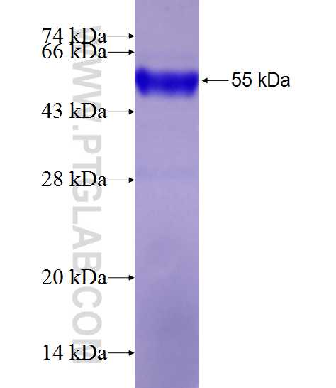 C1orf35 fusion protein Ag20769 SDS-PAGE