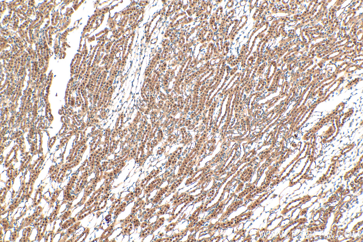 Immunohistochemistry (IHC) staining of mouse kidney tissue using C1orf50 Polyclonal antibody (20957-1-AP)