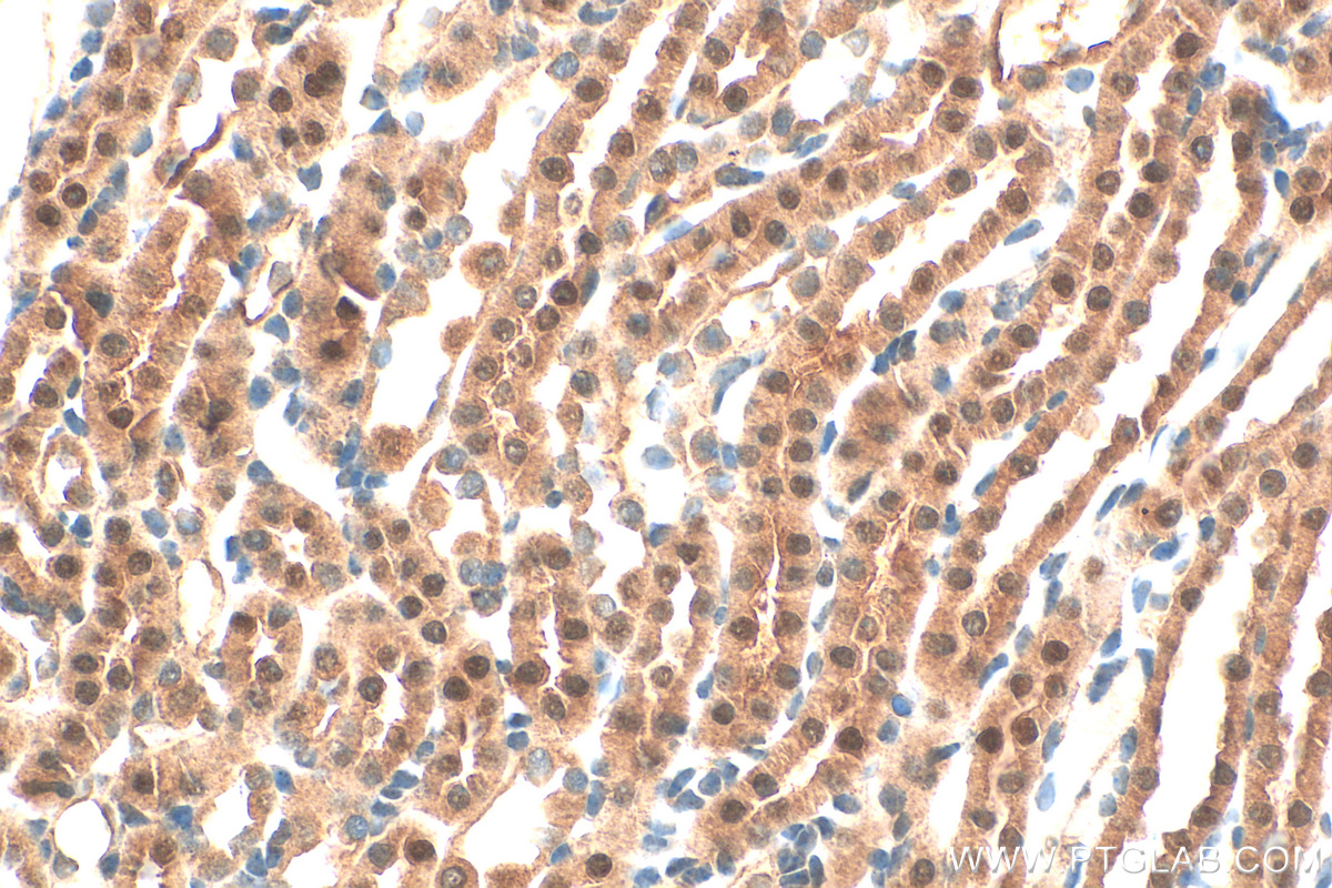 Immunohistochemistry (IHC) staining of mouse kidney tissue using C1orf50 Polyclonal antibody (20957-1-AP)