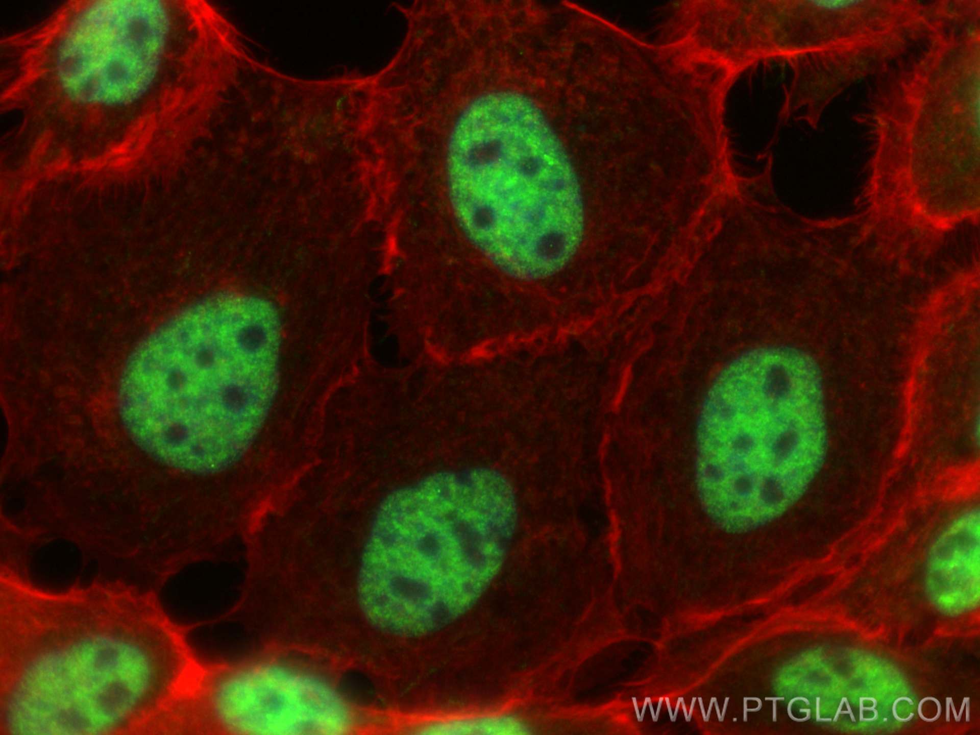 Immunofluorescence (IF) / fluorescent staining of A431 cells using C1orf77 Polyclonal antibody (27478-1-AP)