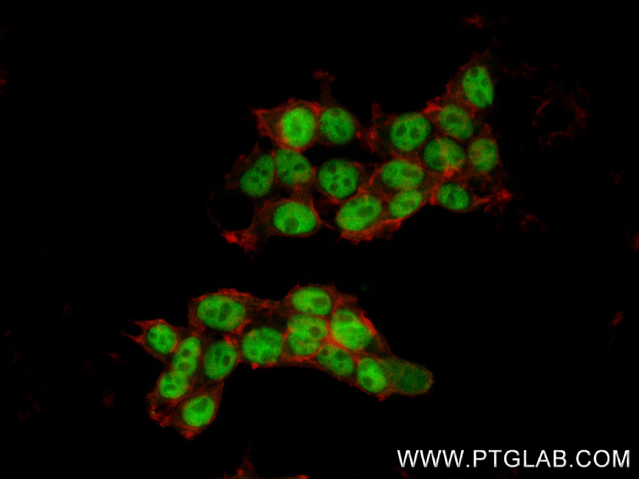 Immunofluorescence (IF) / fluorescent staining of HEK-293 cells using C1orf83 Recombinant antibody (83626-3-RR)