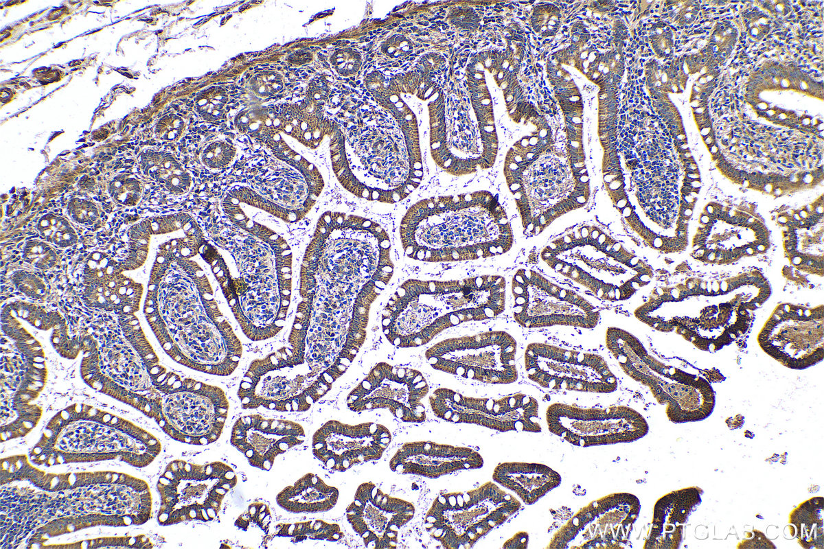 Immunohistochemistry (IHC) staining of human small intestine tissue using SLC52A3 Polyclonal antibody (25626-1-AP)