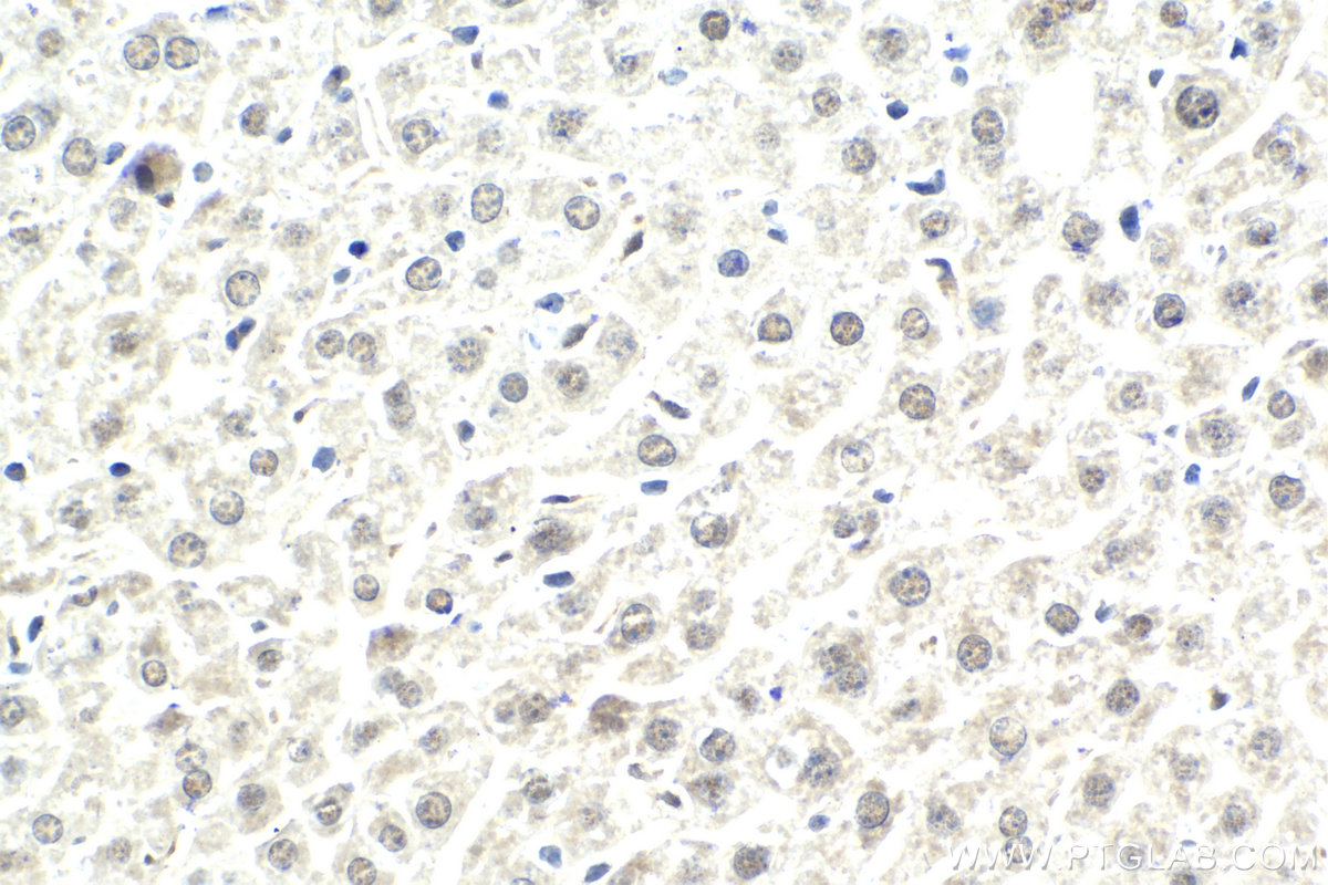 Immunohistochemistry (IHC) staining of mouse liver tissue using C21orf66 Polyclonal antibody (21357-1-AP)