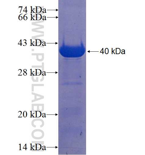 C21orf91 fusion protein Ag22599 SDS-PAGE