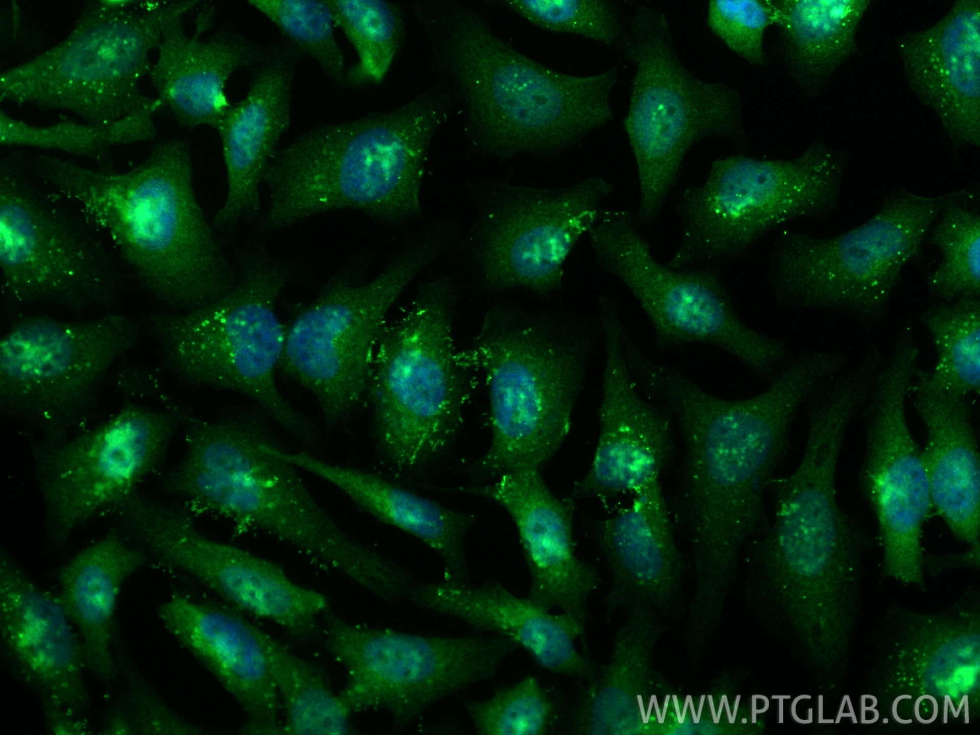 Immunofluorescence (IF) / fluorescent staining of HeLa cells using RTCB-Specific Polyclonal antibody (19809-1-AP)