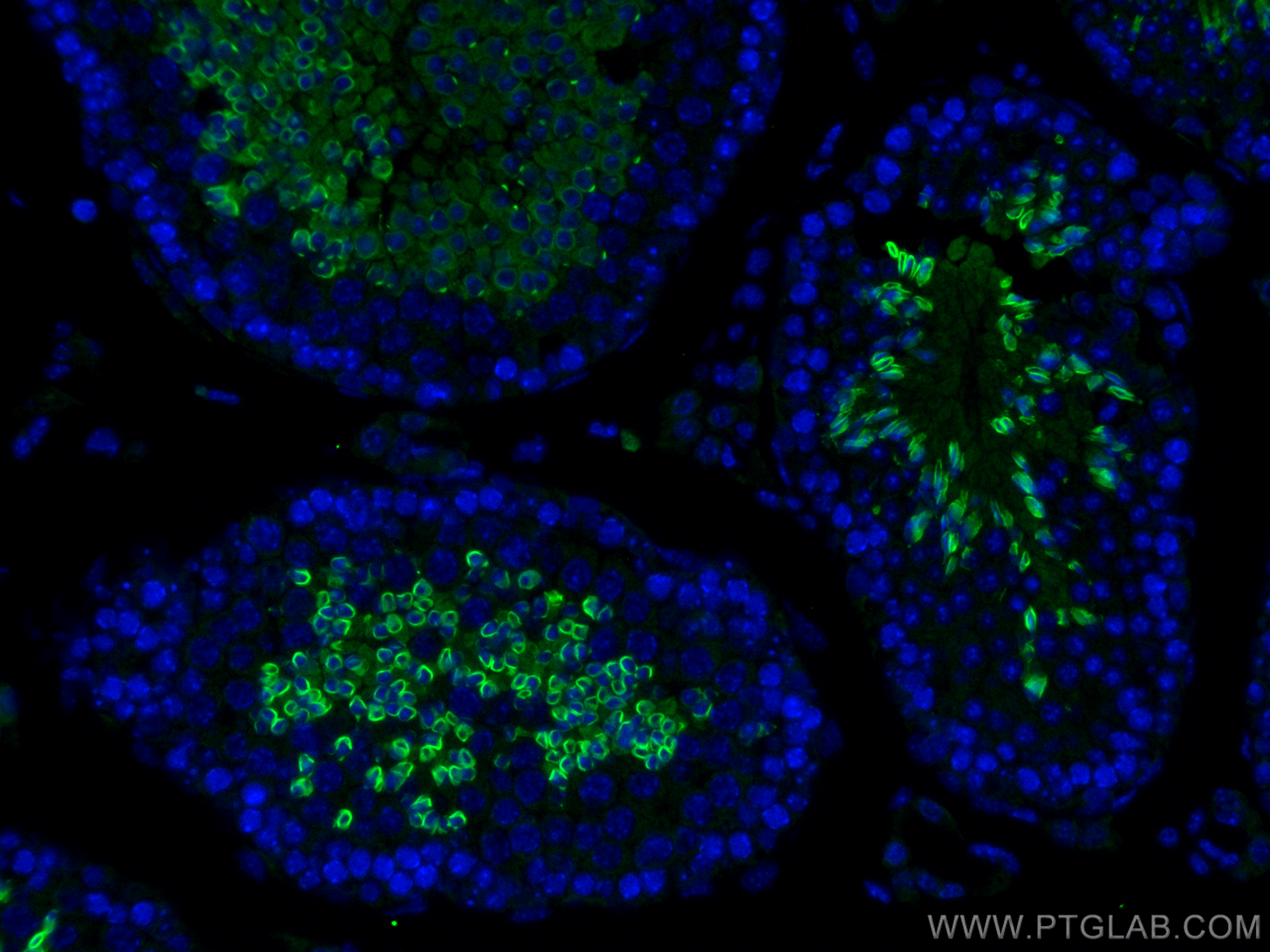 Immunofluorescence (IF) / fluorescent staining of mouse testis tissue using C22orf33 Polyclonal antibody (26577-1-AP)