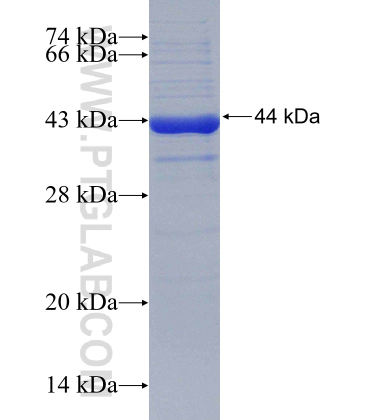 C2orf30 fusion protein Ag31135 SDS-PAGE