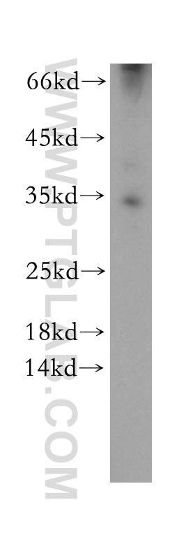 Western Blot (WB) analysis of mouse liver tissue using C2orf49 Polyclonal antibody (18272-1-AP)