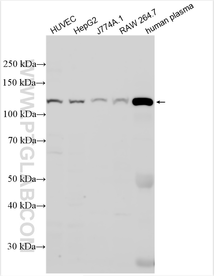 Western Blot (WB) analysis of various lysates using C3/C3b/C3c Monoclonal antibody (66157-1-Ig)