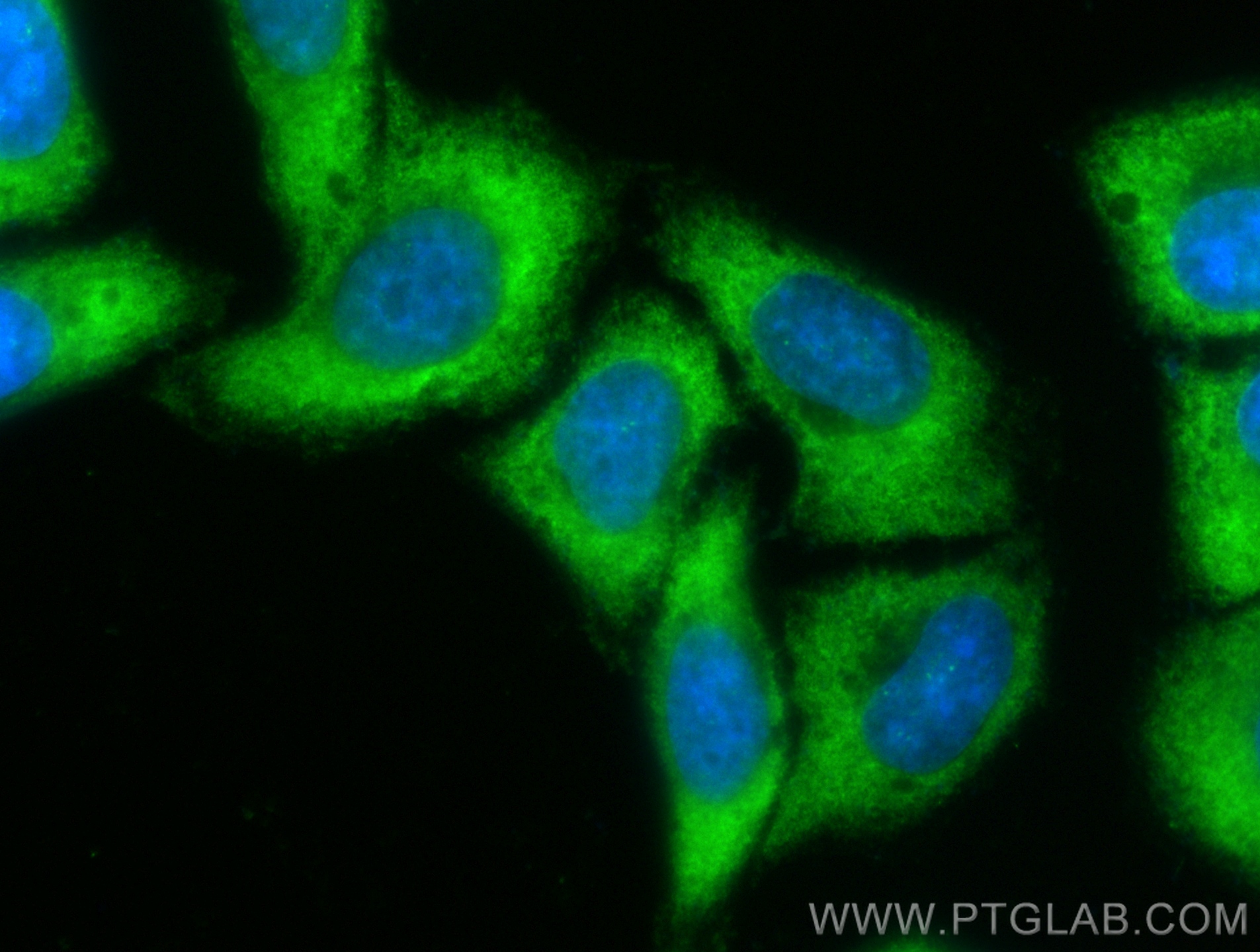 Immunofluorescence (IF) / fluorescent staining of HepG2 cells using CoraLite® Plus 488-conjugated C3/C3b/C3c Polyclona (CL488-21337)