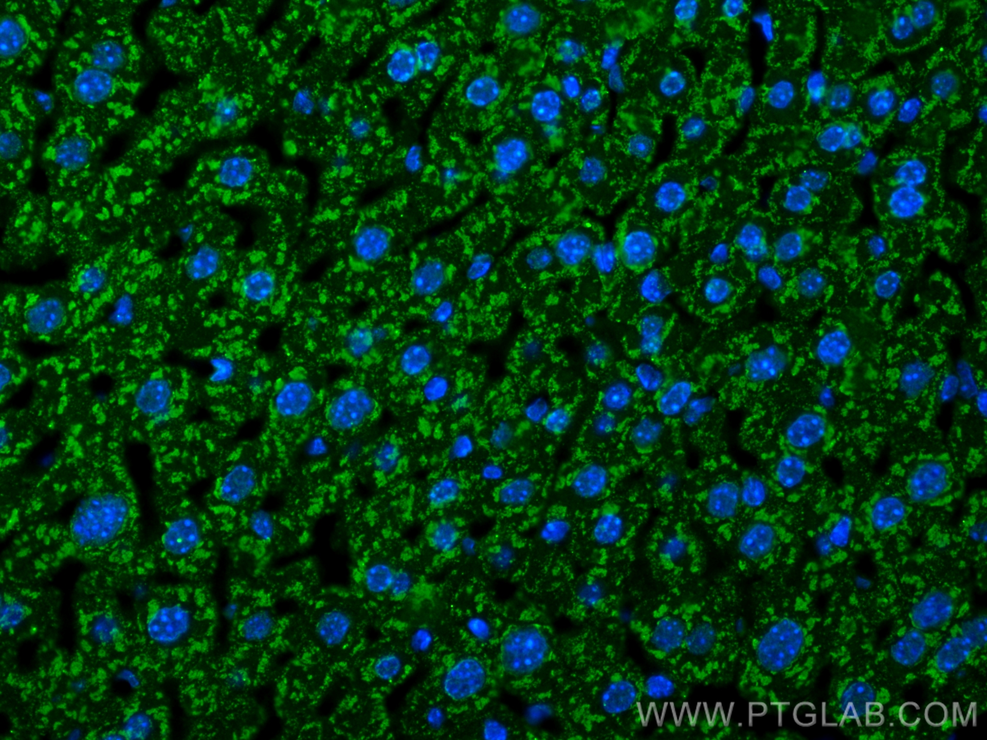 Immunofluorescence (IF) / fluorescent staining of mouse liver tissue using CoraLite® Plus 488-conjugated C4 Gamma Chain Monoc (CL488-66242)