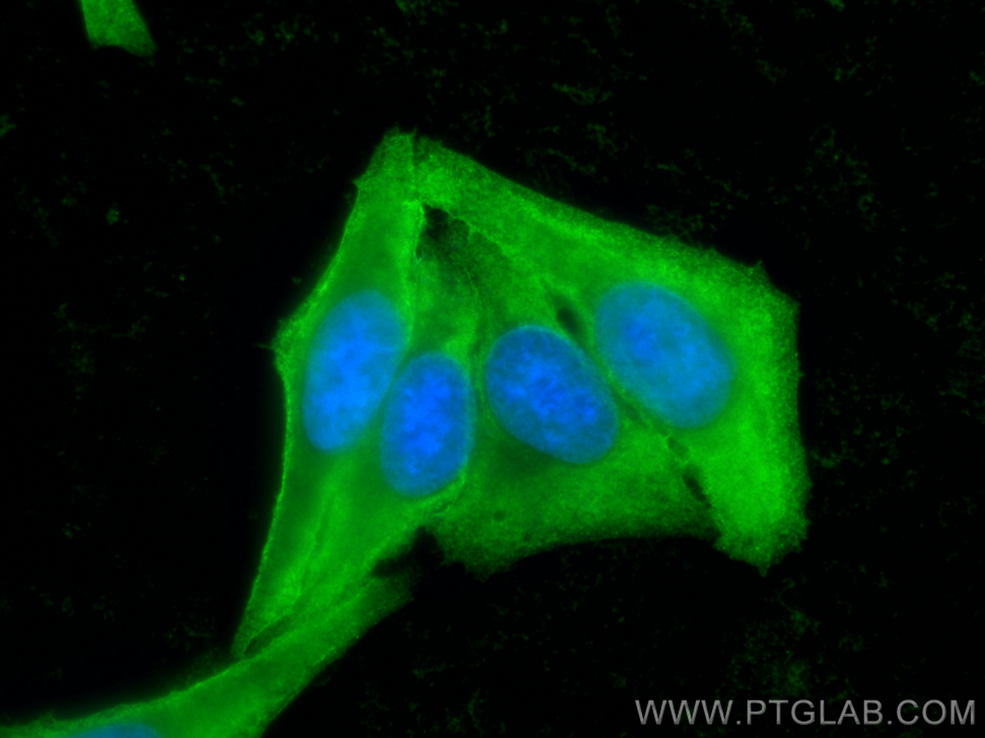 Immunofluorescence (IF) / fluorescent staining of HepG2 cells using C5 Monoclonal antibody (66634-1-Ig)