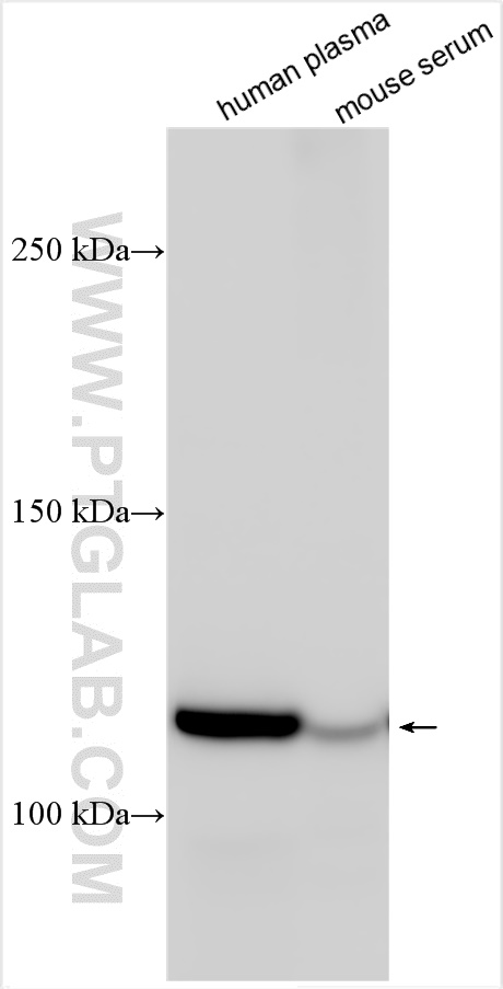 Western Blot (WB) analysis of various lysates using C5 Polyclonal antibody (22492-1-AP)